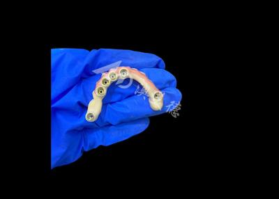 Chine Dentures en titane et couronne en zirconium avec support d'implant Précision adaptée à un usage confortable à vendre