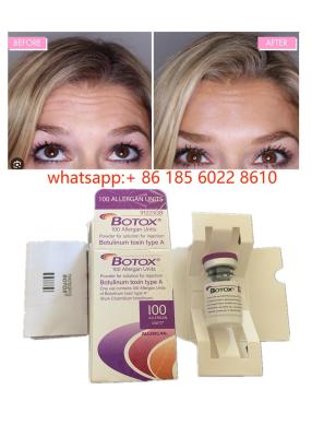 China Allergan Botulinum Toxin 100IU Anti-Wrinkles for sale