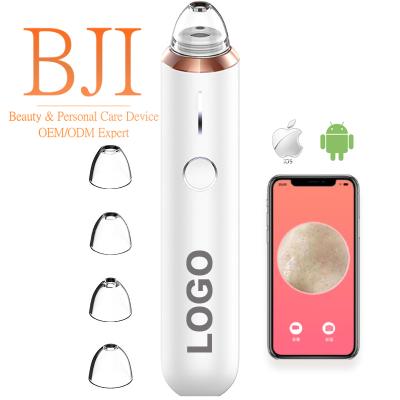 China Acne Removal Blackhead Remover Tool Electric Acne Remover Blackhead Pore Suction Extractor Kit Prime Vacuum for sale