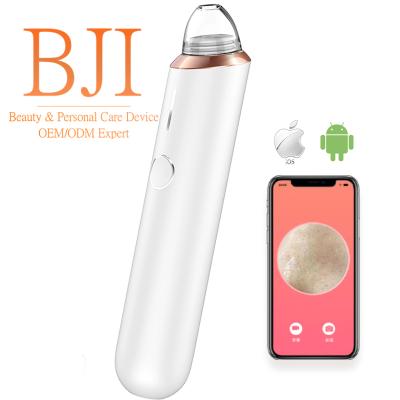 China WIFI HD Blackhead Visible Acne Remover Visual Vacuum Pore Remover Vacuum Suction Blackhead Removal Treatment With Camera for sale