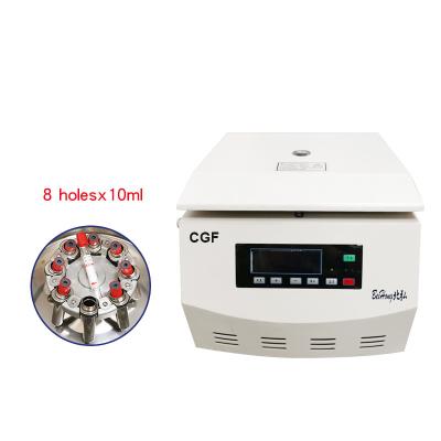 China 4000PRM 10ml Center Force Variable Small Speed FRP Dental Implant Centrifuge Dental Center Cluster for sale