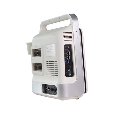 Chine Scanner Windows 7 11KG d'ultrason de la CE 3D Doppler à vendre