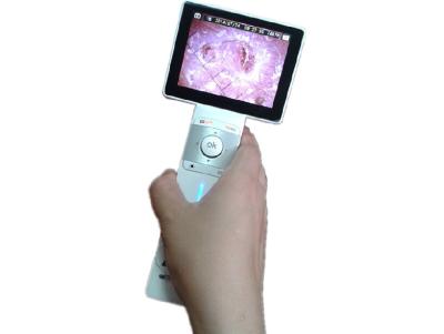 China La máquina de la lupa del pelo de la cámara de la piel de Digitaces con el mini puerto de USB transmite imágenes a la PC que exhibe imágenes al mismo tiempo en venta