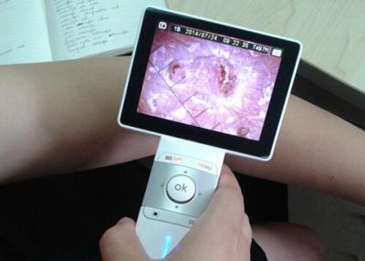 China Lente geral video da imagem latente do micro dispositivo da inspeção da orelha de Digitas do cartão de memória do SD para a inspeção da garganta à venda