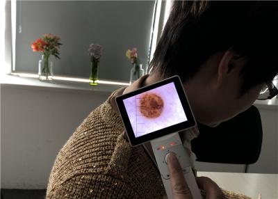 China Puerto de USB opcional del LCD de 3,5 pulgadas de Wifi de Dermatoscope de la resolución de los pixeles 1920*1080 de la piel del pelo de la máquina video del escáner en venta