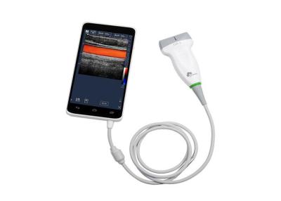 중국 Andriod 색깔 도풀러 초음파 스캐너, 소형 도풀러 기계 550g 무게만 판매용