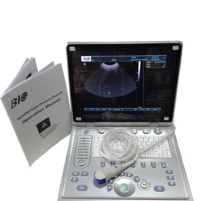 China Laptop Zwart-witte Draagbare Ultrasone klankscanner met 2 Sondeschakelaar en 3D Facultatief Te koop