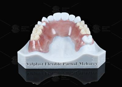China Valplast leve parcial flexível com excelente retenção à venda