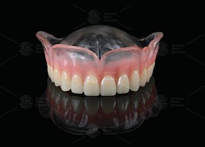 China Vertex Prótese completa clara e rosa Prótese parcial praticamente inquebrável Prótese parcial acessível à venda