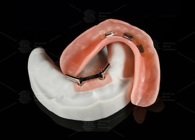Chine L'alliage de titane est utilisé pour l'implantation d'une barre de dentition surdimensionnée. à vendre