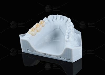 Chine Translucide Blanc à contour complet couronne de zirconium FCZ couronne de zirconium monolithique facile de fraisage à vendre