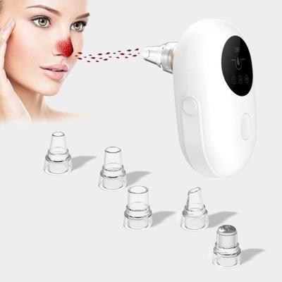 China Blackhead Remover Facial Pore Vacuum Blackhead Remover Remover Byebye Blackhead Suction Face Blackhead Remover Machine Facial Blackhead Remover Tool Kit for sale
