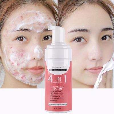 China Acne Treatment Private Label Foam Korean Organic BHA Salicylic Acid Acne Cleansing Clear 4 In 1 Face Wash Facial Deep Foam Cleanser for sale