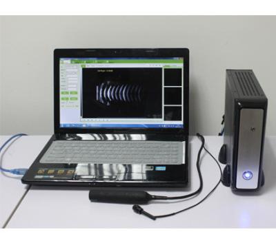 China SV-E200 Ophthalmic A/B Scanner software box, Ophthalmic software for sale