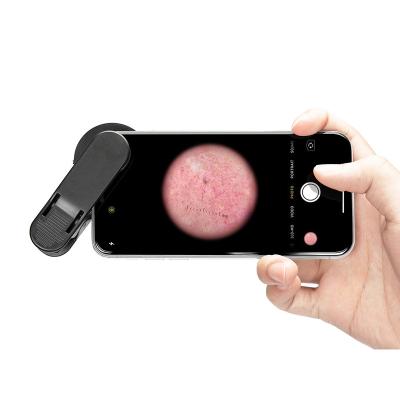 China IBOOLO DE-300 6X High Definition Optical Dermoscopy Dermatoscope For Skin Cancer for sale