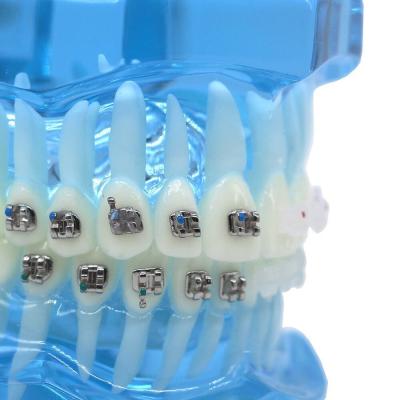 Chine CNC Mini Roth MBT Bracket 0.022 0.018 Marqueur laser à fente Pas de marqueur laser avec sans crochet à vendre