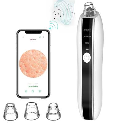 China Black Head Removal Vacuum Ultrasonic Removal Machine Remove Beauty Facial Blackhead Remover for sale