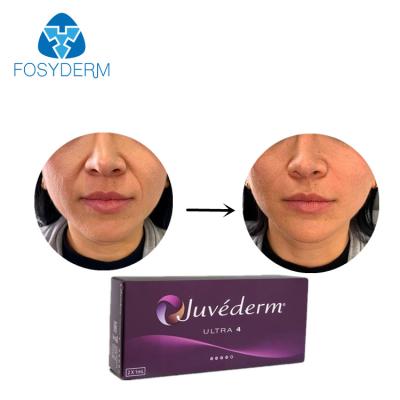 China La cruz de Juvederm ligó el llenador cutáneo ácido hialurónico Allergan ultra 4 en venta