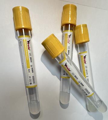 Cina Laboratori diagnostici di attivazione del gel e del coagulo possono essere personalizzati Alta integrità del campione in vendita