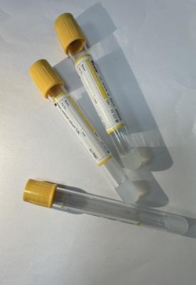Cina Attivatore di coaguli di gel PET di alta trasparenza di plastica ad alto rendimento di recupero giallo in vendita