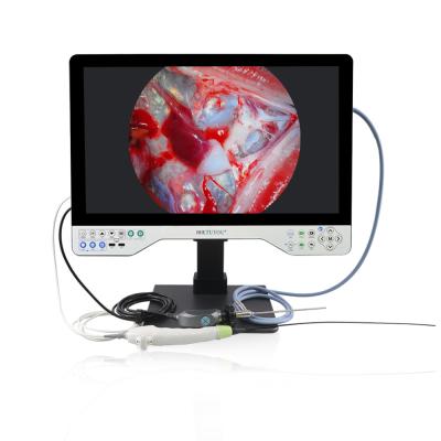 Chine Sélection du mode de moniteur de 15 pouces TUYOU All-in-One Endoscope médical avec source lumineuse pour urologie et gynécologie à vendre