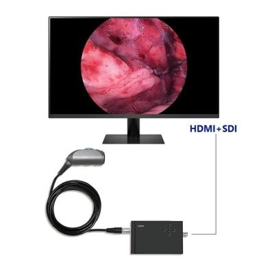 China TUYOU Portable Endoscopy Video Camera Full HD 1920x1080 Resolution 120 Degree Field of View for Urology Spine and ENT Surgery for sale