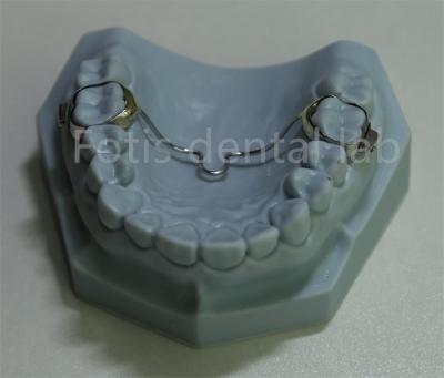 Chine Versatile Dental Expander Retainer Affordable Solution for Most Orthodontic Treatments à vendre