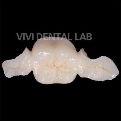 Chine Dentistique Des dents Zirconia Maryland Bridge Haute esthétique Certifié FDA à vendre