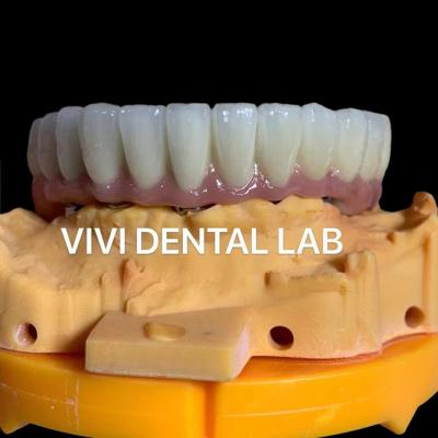 Chine Couronnes dentaires numériques esthétiques couronne translucide d'implant dentaire à vendre