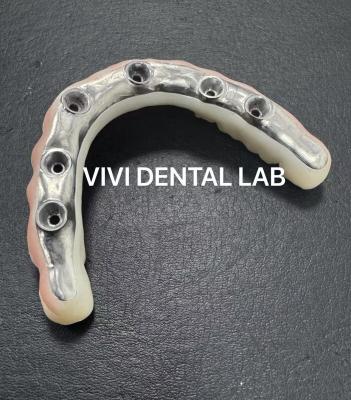 China Esthetic Full Zirconia Bridge With Titanium Bar screwed retained from china dental lab for sale