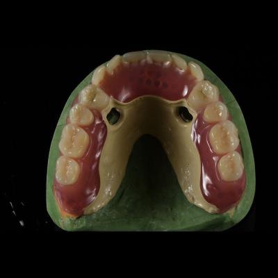 Chine Peek Prothèses partielles thermoplastiques PEEK Cadre à vendre