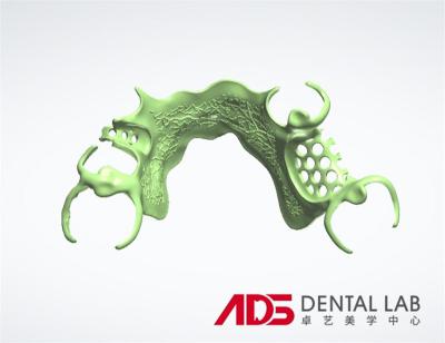 Chine ADS Laboratoire dentaire cadre métallique partiel cadre dentaire fabrication à vendre