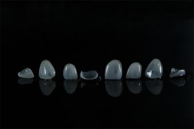 China E.max Dental Veneers from direct China dental lab en venta