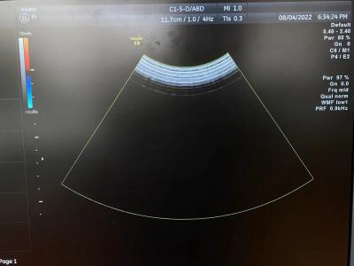 China GE Logiq S7 konvexe Anordnung Original Ultraschallwandlersonde C1-5-D zu verkaufen