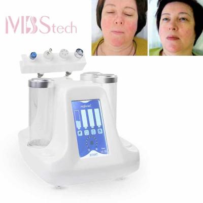 China De Machine van zuurstofjet peel multipolar rf hydrafacial Dermabrasion Te koop