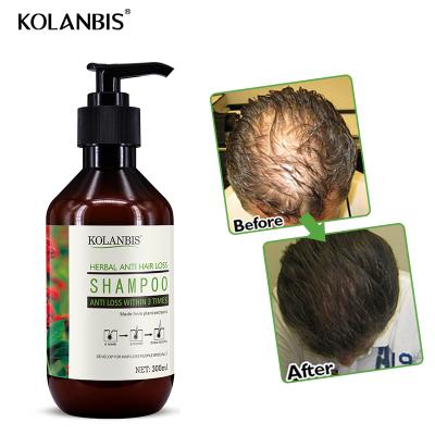 China Color-protecting Organic Herbal Oil-control Hair Growth Shampoo For Woman Hair Loss Treatment for sale