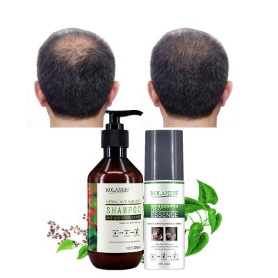 China Loss Prevention Hair Shampoo and Serum Organic Herbal Set for Colored Hair Loss Treatment Treatment Alopecia for sale