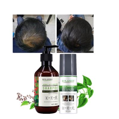China Organic Loss Prevention Hair Repair Treatment Spray Oil and Shampoo Ginger Extract Hair Treatment Set for sale