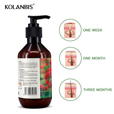 China Wholesale Anti Loss Prevention OEM Hair Loss Shampoo Promote Hair Growth No Side Effects 300ml for sale