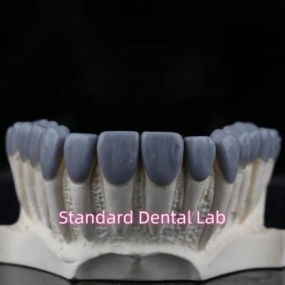 Cina Dental Crown Wax Up Estetica elevata in vendita