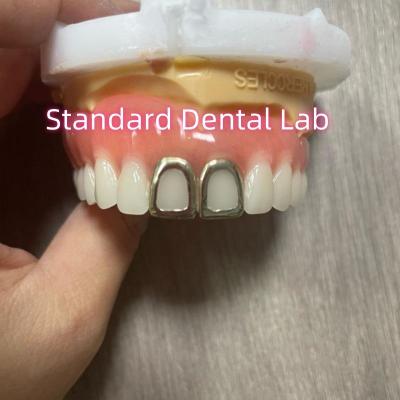 Cina Dentiere acriliche ISO con denti d'oro giallo in vendita
