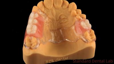 China Flexible marco de metal fundido transparente dentaduras parciales alta estética ajuste perfecto en venta