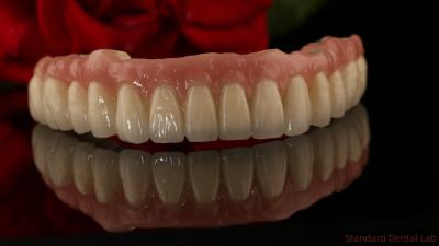 China Zirconia Titanium Dental Implants All On 4 Full Arch Teeth Replacement 3-6 Months Healing Time for sale