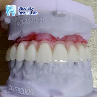 China Personaliza el color de las cajas de instrumentos de implantación de superficie lisa en venta