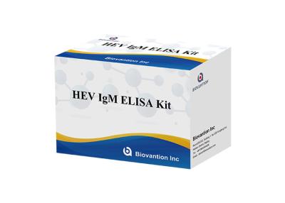 China Plasma de HEV IgM Elisa Test Kit Serum Vs para a detecção do anticorpo à venda