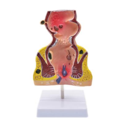 China Medical PVC Human Rectum Anatomical Model for sale