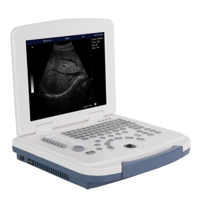 China HBW-4 Full Metal Laptop Digital B/W Ultrasound Machine for sale