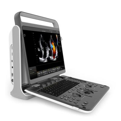 China Portable Metal 4D Color Doppler Ultrasound Machine CHISON EBit 60 for sale