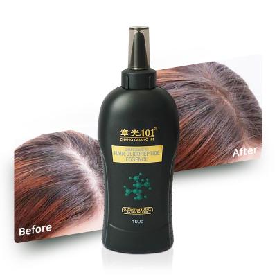 China 100% Natural Herbal Hair Growth Custom Logo Best Quality Natural Fast Oil For Business Man for sale