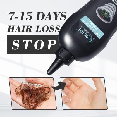 China Custom Logo Nourishing Scalp Anti Hair Loss Prevention Anti Hair Loss Treatment Serum For Men And Women for sale